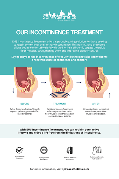 image of how urge incontinence Sutton in Ashfield treatment works