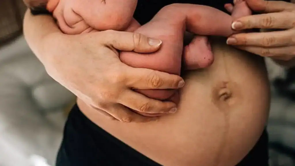 Why Is My Stomach Still Big After Pregnancy Sutton in Ashfield?